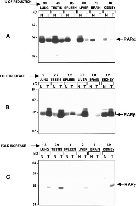 Fig. 4. Reduction of RARα protein by the RARα antisense construct and compensatory increase in the RARβ and RARγ proteins. Western blot analysis of protein isolated from normal control (N) mice and transgenic (T) mice (line 2) from the indicated organs. Equal amounts of protein were resolved on SDS-PAGE, transferred to nitrocellulose membrane, and probed with specific RARα (A), RARβ (B), and RARγ (C) antisera as indicated. The percentage of RARα reduction in each tissue is indicated in (A) and the levels of increase in RARβ and RARγ proteins are shown in (B and C).