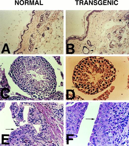 Fig. 5. Histologic changes in the RARα antisense mice as compared with normal littermates. Sections of skin of normal (A) and transgenic (B) mice showing significant atrophy and degeneration in pilosebaceous units (arrowhead) in transgenic mice (B) as compared with normal mice (A). (C) and (D) are sections from normal and transgenic mice, respectively. Poor order of spermatogenesis (arrow) and few spermatozoa are seen in the seminiferous tubules of transgenic mice as compared with those of normal mice. Sections of epididymides of normal (E) and transgenic (F ) mice show marked squamous metaplasia (arrow) in transgenic mice, but pseudostratified epithelium in normal mice (arrow).