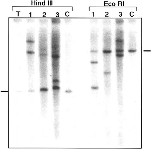 Fig. 7. Clonality of the lymphoid tumors as demonstrated by immunoglobulin gene rearrangement studies. Southern blot analysis of some lymphoid tumors showing immunoglobulin gene rearrangement. Three different lymphomas (labeled 1-3) were digested with EcoRI and HindIII as indicated. C, control liver DNA from one of the mice; T, DNA from a T-cell lymphoma showing no rearrangement for the immunoglobulin gene. Germline band is indicated by a dash on the side.