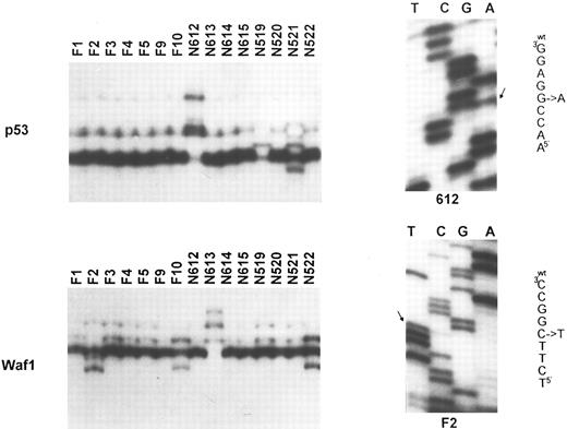 Fig. 2. Molecular analysis of the p53 and p21 genes. Top (left): SSCP analysis of the p53 gene (exon 7). Tumor identification numbers are given on the top of each lane. Cases N612, N519, and N521 show an abnormal migration pattern; (right) sequence analysis of case N612, showing the presence of a G to A transition at codon 248. Bottom (left): SSCP analysis of the p21 gene (exon 2). Cases F2, F10, N613, and N522 show a band shift. This was due to a C to T polymorphism at codon 22 for case F2 (sequence analysis on the right), a C to A polymorphism at codon 31 for cases F10 and N522, and to a C to T somatic mutation at codon 20 for case N613.