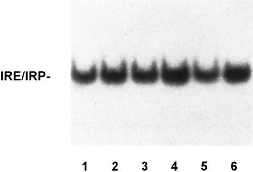 Fig. 2. IRP activity in lymphocytes of controls and GH patients. Lysates of lymphocytes from controls (lanes 1 to 3) and unrelated GH patients, untreated (lane 4) or treated (lanes 5 and 6), were assayed for IRP activity as described in the legend to Fig 1. IRP activity was not significantly different in the various samples.