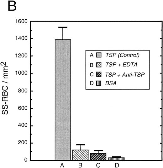 Fig. 2. Sickle and normal RBC adherence to immobilized TSP. (A) Glass slides were coated with varying concentrations of TSP (2.5 to 100 μg/mL) and adhesion of normal and sickle RBC assessed under flow conditions as described in Fig 1. Error bars are standard deviation (SD) of 10 randomly chosen microscopic fields from one representative experiment. (B) Slides were coated with TSP (50 μg/mL) or BSA as described in Materials and Methods. In some experiments, the slides were additionally treated with EDTA (5 mmol/L) or a 1:2 dilution of a rabbit polyclonal anti-TSP antiserum (R1)34 before RBC perfusion. Error bars are SEM.