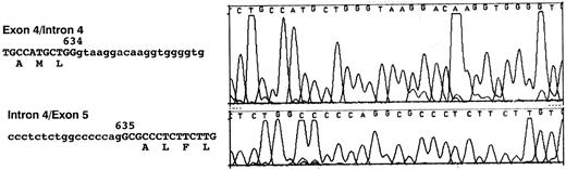 Fig. 3. Nucleotide sequences of exon 4/Intron 4 and Intron 4/exon 5 boundaries. Nucleotide sequences obtained at the intron/exon boundaries of both cloned RHCE and RHD genes are displayed. Exonic sequences are shown in uppercase, intronic sequences in lowercase. The last nucleotide of exon 4 and the first of exon 5 are numbered. The numbering corresponds to the Rh cE and D cDNAs with nucleotide 1 being the first base of the ATG triplet. A representative sequence electropherogram generated during sequence analysis of these regions is displayed in this figure.
