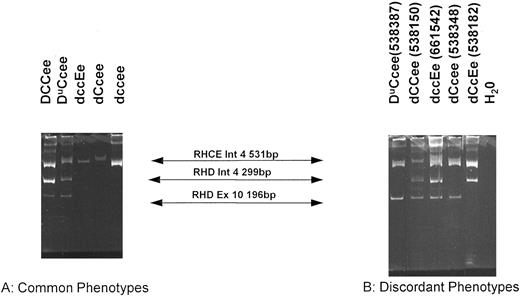 Fig. 4. Multiplex PCR analysis of the RHD gene. This figure shows the products of the multiplex reaction after separation on 6% acrylamide gels. Products of 531 bp (RHCE intron 4); 299 bp (RHD intron 4) and 196 bp (RHD exon 10). Products are indicated between the two panels. (A) Illustrates samples that are concordant (all normal D+ and dce phenotypes; representing the majority of all samples tested) and (B) illustrates discordant samples. The Rh phenotype of each sample is indicated above each track. All samples on (A) and those on (B) were run on the same gel.