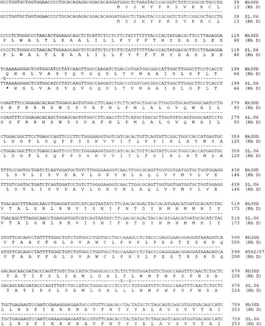Fig. 5. Nucleotide sequence of Rh D transcripts isolated from donor 538150. The nucleotide sequence obtained after DNA sequence analysis of 538150 RHD transcripts is shown. The sequence obtained from two different full-length cDNA clones was found to be identical.