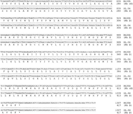 Fig. 5. Nucleotide sequence of Rh D transcripts isolated from donor 538150. The nucleotide sequence obtained after DNA sequence analysis of 538150 RHD transcripts is shown. The sequence obtained from two different full-length cDNA clones was found to be identical.