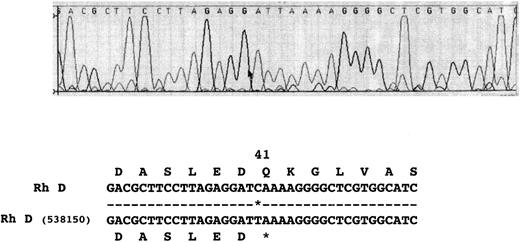 Fig. 6. Nucleotide sequence of Rh D transcript isolated from donor 538150 in the codon 41 region. The sequence electropherogram from the Applied Biosystems 373A DNA sequencer is displayed. The single point mutation generating the in-frame stop codon occurs at codon 41. The nucleotide sequence and inferred amino acid sequence is illustrated below the electropherogram.