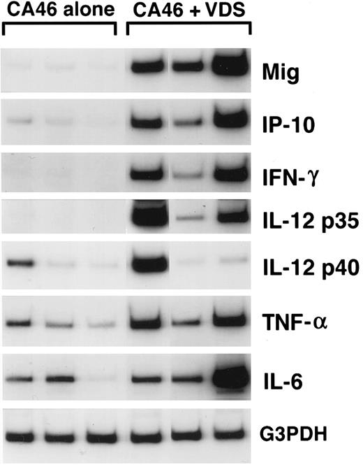 Fig. 1. Cytokine and chemokine mRNAs in regressing and progressive Burkitt's tumors shown by semiquantitative RT-PCR analysis. Tissue fragments were obtained from regressing and progressive Burkitt's tumors established in BALB/c nu/nu mice by subcutaneous inoculation of 107 BL cells (CA46 cell line). Tumor regression was induced by weekly intratumor inoculation of 107 LCL (VDS cell line), as described. Regressing tumors were harvested when LCL-treated Burkitt's tumors developed typical tumor necrosis and scarring, lesions that are indicative of an effective antitumor response. Progressive tumors were harvested from untreated Burkitt's tumors. Total cellular RNA, isolated from tumor tissues, was subjected to RT-PCR analysis.
