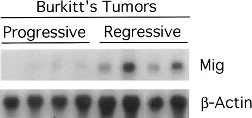 Fig. 2. Expression of murine Mig mRNA in progressive and regressing Burkitt's tumors assessed by Northern blot analysis. Total RNA was extracted from tissue fragments of progressively growing or regressing Burkitt's tumors induced as desribed in the legend to Fig 1, separated on a 1.2% agarose gel, transferred to nitrocellulose membrane, and hybridized for murine Mig and G3PDH.
