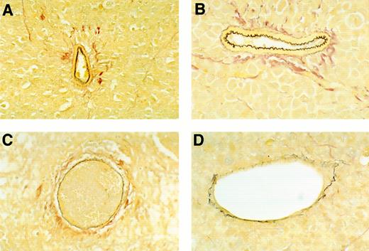 Fig. 4. Microscopic morphology of BL vessels evaluated by staining with EVG reagent that is specific for elastin fibers in the external and internal elastic lamina of muscular arteries and the internal elastin lamina of large arterioles. Elastin fibers stain dark brown with EVG reagent. (A and B) Normal appearing patent vessels with continuous and regularly folded elastin laminas in tumor tissue from a mouse treated with formulation buffer. (C and D) Damaged vessels with fragmented or flattened elastin laminas associated with intravascular thrombosis in tumor tissue from a mouse bearing a regressing Burkitt's tumor treated with human rMig. (A and C), original magnification ×40; (B and D), original magnification ×63.
