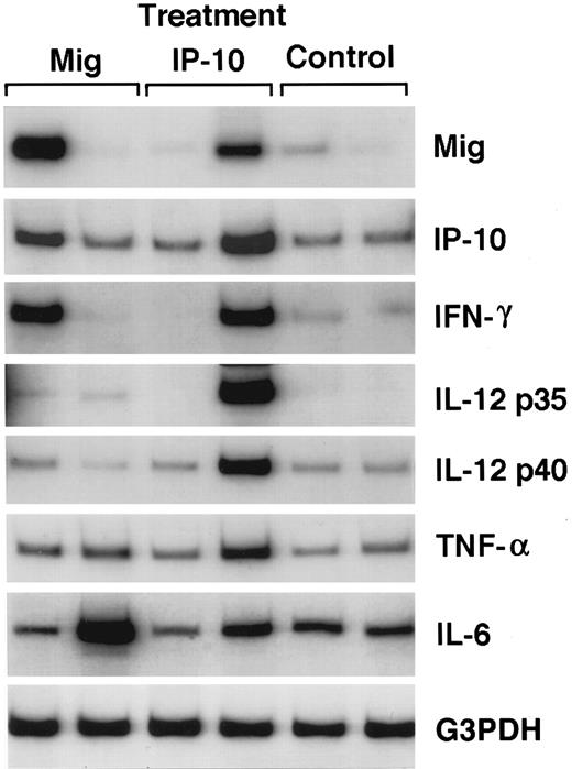 Fig. 5. Representative patterns of cytokine and chemokine mRNA expression in Mig-, IP-10–, or buffer-treated Burkitt's tumors shown by semiquantitative RT-PCR analysis. Total cellular RNA was extracted from Burkitt (CA46 cell line) tumors established in athymic mice and subsequently treated with intratumor inoculations of either human rMig (400 ng/d), human rIP-10 (400 ng/d), or diluent (0.2 mL/d), as described in the legend to Table 1.