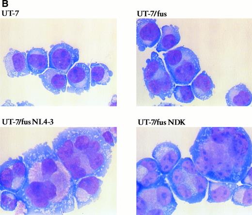 Fig. 6. Morphologic analysis of UT-7, UT-7/fus, and HIV-infected UT-7/fus cells. (A) Analysis of UT-7, UT-7/fus, and NL4-3 or NDK HIV-1–infected UT-7/fus cells on the basis of nuclei number (N) as evaluated by optical microscopy. Results from a representative experiment are shown. (B) Cytospin of uninfected UT-7 and UT-7/fus cells compared with UT-7/fus cells infected with NL4-3 or NDK HIV-1 strains. (Original magnification × 400.)