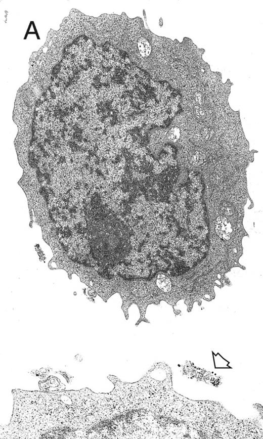Fig. 6. Electron microscopy evaluation of MP generated from purified CD34+ cells cultured for 7 days in the presence of MIP-1α, IL-3, IL-6, IL-11, FL, SCF, and MGDF. In (A) (original magnification × 11,230), an MP cell shows a sparse chromatin, a nucleolus, and few vacuoles and polyribosomes; the cell outline shows some microvilli and few gold particles indicating CD61 labeling (see arrow in the inset; original magnification × 25,120). A significantly more pronounced CD61 labeling is shown in the more differentiated MP in (B) (original magnification × 9,250).