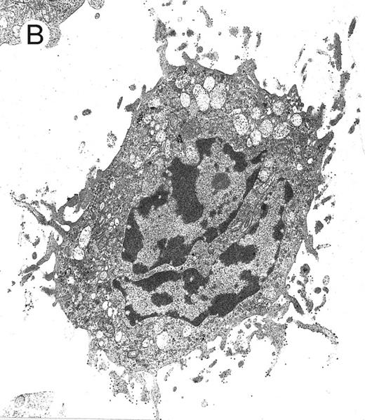 Fig. 6. Electron microscopy evaluation of MP generated from purified CD34+ cells cultured for 7 days in the presence of MIP-1α, IL-3, IL-6, IL-11, FL, SCF, and MGDF. In (A) (original magnification × 11,230), an MP cell shows a sparse chromatin, a nucleolus, and few vacuoles and polyribosomes; the cell outline shows some microvilli and few gold particles indicating CD61 labeling (see arrow in the inset; original magnification × 25,120). A significantly more pronounced CD61 labeling is shown in the more differentiated MP in (B) (original magnification × 9,250).