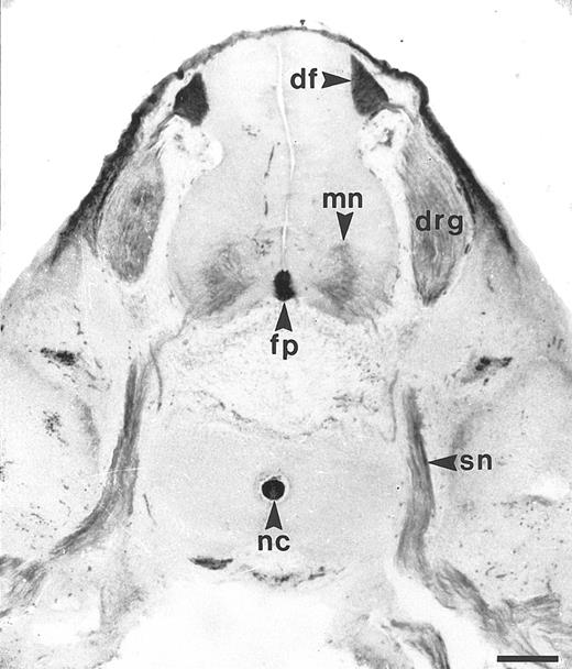 Fig. 1. Expression of F84.1/HCA in the developing human spinal cord. The developing human spinal cord was studied using F84.1 MoAb on transverse sections of human embryos, at the trunk level, a 7 weeks postconception. The majority of the motoneurons (mn) of the neural tube have been born and have started to extend axons to form the spinal nerves (sn). Both their cell bodies and axons display strong F84.1 reactivity. At the midline of the neural tube, the floor plate (fp) is also intensely stained. Cell bodies and axons of the DRG neurons that arise from the neural crest also exhibit a strong expression of F84.1 epitope. The central projections of these axons form the dorsal funiculus (df ) in the spinal cord, which is intensely labeled. Nonneuronal tissues such as the notochord and surface ectoderm are also strongly reactive.