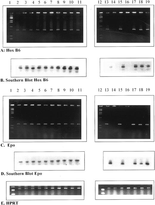 Fig. 3. Ethidium bromide gels (A and C) and Southern blots (B and D) for HOX B6 and EPO compared with HPRT control gene expression (E) in different tissues and organs during murine development. Lane 1, markers; lane 2, 6.5-day embryo; lane 3, 7.5-day embryo; lane 4, 8.5-day embryo; lane 5, 9.5-day embryo; lane 6, 10.5-day embryo; lane 7, 11.5-day embryo; lane 8, 12.5-day fetal liver; lane 9, 13.5-day fetal liver; lane 10, 14.5-day fetal liver; lane 11, 15.5-day fetal liver; lane 12, markers; lane 13, 16.5-day fetal liver; lane 14, 17.5-day fetal liver; lane 15, 17.5-day fetal spleen; lane 16, 18.5-day fetal liver; lane 17, 18.5-day fetal spleen; lane 18, 19.5-day fetal liver; and lane 19, 0.5-day liver.