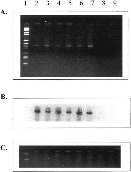 Fig. 4. Expression of HOX B6 from in vitro erythropoietic progenitor cell colonies (CFU-E after 48 hours and BFU-E after 10 days incubation) and in colonies derived from HPP-CFC (after 14 days of incubation). (A) Ethidium bromide gel for HOX B6. (B) Southern blot for HOX B6. (C) HPRT control. Lane 1, markers; lane 2, erythroid colonies from 8.5-day embryos; lane 3, erythroid burst colonies from 8.5-day embryos; lane 4, erythroid colonies from 13.5-day fetal liver; lane 5, erythroid burst colonies from 13.5-day fetal liver; lane 6, erythroid colonies from adult bone marrow; lane 7, erythroid burst colonies from adult bone marrow; lane 8, colonies from 13.5-day fetal liver HPP-CFC; and lane 9, colonies from adult bone marrow HPP-CFC.