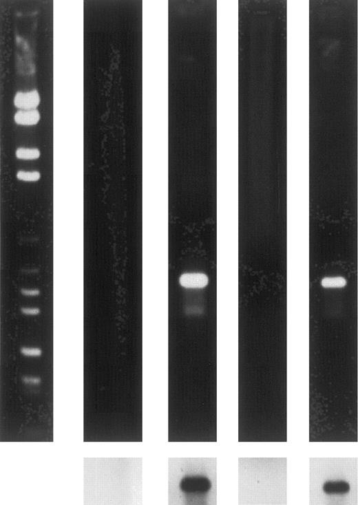 Fig. 5. Ethidium bromide-stained gels (upper panels) and Southern blots (lower panels) showing expression by RT-PCR of HOX B6 in TER-119–separated 13.5-day fetal liver and adult bone marrow cells. From left to right-hand lane: markers; 13.5-day fetal liver TER-119− population; 13.5-day fetal liver TER-119+ population; adult bone marrow TER-119− population; and adult bone marrow TER-119+ population.