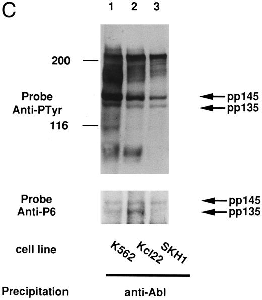 Fig. 7. pp135 was constitutively tyrosine-phosphorylated and associated with Shc and Bcr-Abl in CML cell lines. The lysates from three human CML (K562, Kcl22, and SKH1) and human AML (HL-60) cell lines were mixed with anti-Shc (A) or anti-P6 antibody (B). The resulting precipitates were subjected to SDS-PAGE and immunoblotted with anti-Py (top panels) and reprobed with anti-P6 (bottom panel of A). The lysates from these CML cell lines were also mixed with anti-Abl antibody (C). The precipitates were subjected to SDS-PAGE and immunoblotted with anti-Py (top panel) and reprobed with anti-P6 (bottom panel). The arrow indicates the position of pp135 and pp145. Molecular weight markers, indicated at the left, are given in kilodaltons.