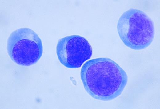 Fig. 5. The morphology of sorted HTK+ cells. HTK+c-Kit+ cells in human bone marrow mononuclear cells were sorted by FACS Vantage (May-Grünwald-Giemsa staining, original magnification × 400).