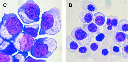 Fig. 7. Expression of HTK on cultured erythroid cells. Purified immature BFU-E from human peripheral blood were cultured. The expression of HTK and glycophorin A on cultured cells was analyzed by FACS on (A) day 6 and (B) day 14. The morphology of cultured cells was also examined on (C) day 6 and (D) day 14 (May-Grünwald-Giemsa staining, original magnification × 400).