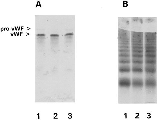 Fig. 1. Subunit composition and multimeric pattern of the vWFs. The rvWFs were reduced and after SDS-PAGE (4% to 15%) the proteins were blotted. Detection was carried out using peroxidase-labeled rabbit anti-vWF Igs. These antibodies were detected by incubation with diamino-benzidine-tetrahydrochloride: lane 1, WT-vWF; lane 2, R543Q-vWF; lane 3, R543W-vWF. (B) For multimeric pattern analysis the proteins were blotted after electrophoresis using 1.7% agarose gel and detected as described above: lane 1, WT-vWF; lane 2, R543Q-vWF; lane 3, R543W-vWF.
