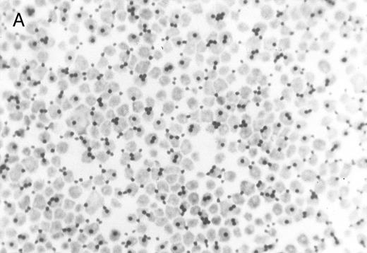 Fig. 3. Chlorate inhibition of sulfation does not block KG1a L-selectin ligand activity. Representative results of adherence assay are shown as performed on (A) untreated KG1a; (B) KG1a immediately after neuraminidase treatment; and (C) KG1a 24 hours after neuraminidase treatment, cultured in the presence of 10 mmol/L sodium chlorate. The small solid circles are lymphocytes adherent to large, pale KG1a cells (methyl green-thionine stain, original magnification × 250).