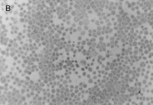 Fig. 3. Chlorate inhibition of sulfation does not block KG1a L-selectin ligand activity. Representative results of adherence assay are shown as performed on (A) untreated KG1a; (B) KG1a immediately after neuraminidase treatment; and (C) KG1a 24 hours after neuraminidase treatment, cultured in the presence of 10 mmol/L sodium chlorate. The small solid circles are lymphocytes adherent to large, pale KG1a cells (methyl green-thionine stain, original magnification × 250).