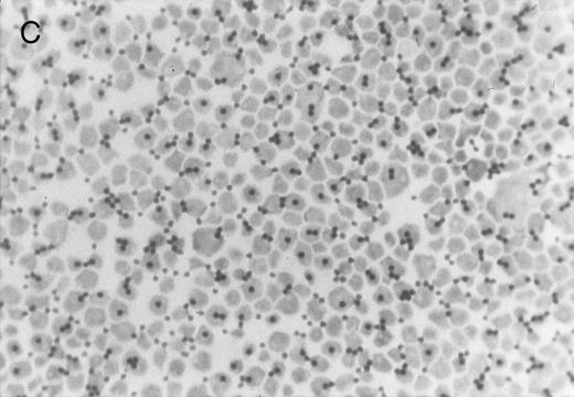 Fig. 3. Chlorate inhibition of sulfation does not block KG1a L-selectin ligand activity. Representative results of adherence assay are shown as performed on (A) untreated KG1a; (B) KG1a immediately after neuraminidase treatment; and (C) KG1a 24 hours after neuraminidase treatment, cultured in the presence of 10 mmol/L sodium chlorate. The small solid circles are lymphocytes adherent to large, pale KG1a cells (methyl green-thionine stain, original magnification × 250).