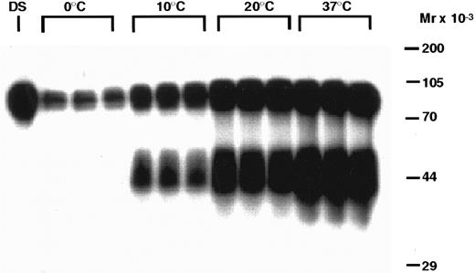 Fig. 5. Temperature-dependent degradation of 125I-rhTPO by human PRP. PRP was incubated with 125I-rhTPO at 0°C, 10°C, 20°C, or 37°C for 60 minutes. Platelet-associated radioactivity (n = 3 per data point) was then analyzed by SDS-PAGE and autoradiography. Nonincubated 125I-rhTPO dosing solution (DS) was also run in the first lane of the gel. Temperature (in degrees Celsius) is indicated on the top of the figure and approximate MW (determined from prestained MW markers) is presented on the right axis.