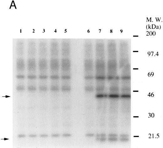 Fig. 2. (A) Thrombopoietin does not induce phosphorylation of pleckstrin or myosin light chain. 32Pi-loaded platelets were stimulated with either thrombopoietin (100 ng/mL) or thrombin (1 U/mL). Whole cell lysates were separated by SDS-PAGE (7.5% to 15% gel). Gels were dried and autoradiographed. Lanes 1 and 6, resting platelets; lanes 2 to 5, 15 seconds, 1 minute, 5 minutes, 10 minutes after addition of thrombopoietin (100 ng/mL); lanes 7 to 9, 15 seconds, 1 minute, 2 minutes after addition of thrombin (1 U/mL). The upper arrow indicates the relative position of pleckstrin; the lower arrow, myosin light chain. (B) Effects of BAPTA-AM and Ro 31-8220 on tyrosine phosphorylation of Vav induced by thrombin or thrombopoietin. Platelets were preincubated with BAPTA-AM (40 μmol/L) and Ro-31-8220 (10 μmol/L) in the presence of 1 mmol/L EGTA for 15 minutes. After the incubation, thrombin (1 U/mL, lane 2) or thrombopoietin (100 ng/mL, lane 3) was added to the platelet suspension. After 10 minutes, platelets were lysed by the addition of an equal amount of a buffer containing 2% Triton X-100. Tyrosine phosphorylation of Vav was detected as in Fig 1 (upper panel). The same PVDF membrane used in the upper panel was stripped and reprobed for Vav (lower panel).