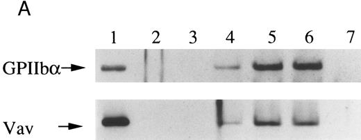 Fig. 4. Association of Vav and GPIIb α with the Triton X-100 insoluble residue (A) and its cleavage in platelets (B and C). (A) Platelets were lysed with Triton X-100-EGTA buffer before or after stimulation with thrombin (1 U/mL) with or without stirring. Lysates were separated into soluble and insoluble residue. Proteins from each fractions were separated by 10% SDS-PAGE and immunoblotted with Vav antisera (lower panel) or an anti-GPIIbα monoclonal antibody (AP4) (upper panel). Lane 1, Triton X-100 soluble residue of resting cells (7.5 × 106 cells); lane 2, Triton X-100 insoluble residue of resting cells (3.0 × 107 cells); lanes 3 to 6, Triton X-100 insoluble residue from 3.0 × 107 cells, 15 seconds, 1 minute, 5 minutes, and 10 minutes after exposure to thrombin (1 U/mL) with stirring; lane 7, Triton X-100 insoluble residue of cells (3.0 × 107 cells) stimulated for 10 minutes with thrombin without stirring. (B) Cleavage of calpain (upper panel) and Vav (lower panel). Cleavage of the 80-kD subunit of μ-calpain in human platelets. Platelets were incubated with either calpeptin or DMSO (vehicle of calpeptin, final 0.1%) for 5 minutes. Platelets were then treated with A23187 (1 μmol/L, for 5 minutes), or dibucaine (1 mmol/L, for 15 minutes) in the presence of 1 mmol/L CaCl2 or 5 mmol/L EGTA. Whole platelet lysates (1.5 × 107 cells/lane) were analyzed by 10% SDS-PAGE. Separated proteins were electrophoretically transferred from the gel onto nitrocellulose membranes. Calpain (upper panel) or Vav (lower panel) was detected by immunoblotting with specific monoclonal antibodies. The arrow indicates the relative position of the intact 80-kD subunit of μ-calpain (upper panel) or Vav (lower panel). Lane 1, control, DMSO (final 0.2%) + 1 mmol/L CaCl2; lane 2, A23187 (1 μmol/L, for 5 minutes) + 1 mmol/L CaCl2; lane 3, A23187 (1 μmol/L, for 5 minutes) + 5 mmol/L EGTA; lane 4, A23187 (1 μmol/L, for 5 minutes) + 1 mmol/L CaCl2 + calpeptin (20 μmol/L); lane 5, dibucaine (1 mmol/L, for 15 minutes) + 1 mmol/L CaCl2; lane 6, dibucaine (1 mmol/L, for 15 minutes) + 5 mmol/L EGTA; lane 7, dibucaine (1 mmol/L, for 15 minutes) + 1 mmol/L CaCl2 + calpeptin (20 μmol/L). (C) Cleavage of Vav during platelet aggregation. Platelets were stimulated with thrombin (1 U/mL) for 30 minutes with or with stirring. After the addition of EGTA (final, 5 mmol/L) and EDTA (final, 5 mmol/L), platelets were lysed by boiling in SDS sample buffer. Vav was detected by immunoblotting as described as above. Lane 1, resting; lane 2, thrombin stimulation for 30 minutes with stirring; lane 3, thrombin stimulation for 30 minutes without stirring.