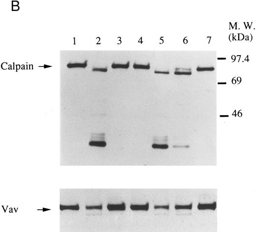 Fig. 4. Association of Vav and GPIIb α with the Triton X-100 insoluble residue (A) and its cleavage in platelets (B and C). (A) Platelets were lysed with Triton X-100-EGTA buffer before or after stimulation with thrombin (1 U/mL) with or without stirring. Lysates were separated into soluble and insoluble residue. Proteins from each fractions were separated by 10% SDS-PAGE and immunoblotted with Vav antisera (lower panel) or an anti-GPIIbα monoclonal antibody (AP4) (upper panel). Lane 1, Triton X-100 soluble residue of resting cells (7.5 × 106 cells); lane 2, Triton X-100 insoluble residue of resting cells (3.0 × 107 cells); lanes 3 to 6, Triton X-100 insoluble residue from 3.0 × 107 cells, 15 seconds, 1 minute, 5 minutes, and 10 minutes after exposure to thrombin (1 U/mL) with stirring; lane 7, Triton X-100 insoluble residue of cells (3.0 × 107 cells) stimulated for 10 minutes with thrombin without stirring. (B) Cleavage of calpain (upper panel) and Vav (lower panel). Cleavage of the 80-kD subunit of μ-calpain in human platelets. Platelets were incubated with either calpeptin or DMSO (vehicle of calpeptin, final 0.1%) for 5 minutes. Platelets were then treated with A23187 (1 μmol/L, for 5 minutes), or dibucaine (1 mmol/L, for 15 minutes) in the presence of 1 mmol/L CaCl2 or 5 mmol/L EGTA. Whole platelet lysates (1.5 × 107 cells/lane) were analyzed by 10% SDS-PAGE. Separated proteins were electrophoretically transferred from the gel onto nitrocellulose membranes. Calpain (upper panel) or Vav (lower panel) was detected by immunoblotting with specific monoclonal antibodies. The arrow indicates the relative position of the intact 80-kD subunit of μ-calpain (upper panel) or Vav (lower panel). Lane 1, control, DMSO (final 0.2%) + 1 mmol/L CaCl2; lane 2, A23187 (1 μmol/L, for 5 minutes) + 1 mmol/L CaCl2; lane 3, A23187 (1 μmol/L, for 5 minutes) + 5 mmol/L EGTA; lane 4, A23187 (1 μmol/L, for 5 minutes) + 1 mmol/L CaCl2 + calpeptin (20 μmol/L); lane 5, dibucaine (1 mmol/L, for 15 minutes) + 1 mmol/L CaCl2; lane 6, dibucaine (1 mmol/L, for 15 minutes) + 5 mmol/L EGTA; lane 7, dibucaine (1 mmol/L, for 15 minutes) + 1 mmol/L CaCl2 + calpeptin (20 μmol/L). (C) Cleavage of Vav during platelet aggregation. Platelets were stimulated with thrombin (1 U/mL) for 30 minutes with or with stirring. After the addition of EGTA (final, 5 mmol/L) and EDTA (final, 5 mmol/L), platelets were lysed by boiling in SDS sample buffer. Vav was detected by immunoblotting as described as above. Lane 1, resting; lane 2, thrombin stimulation for 30 minutes with stirring; lane 3, thrombin stimulation for 30 minutes without stirring.