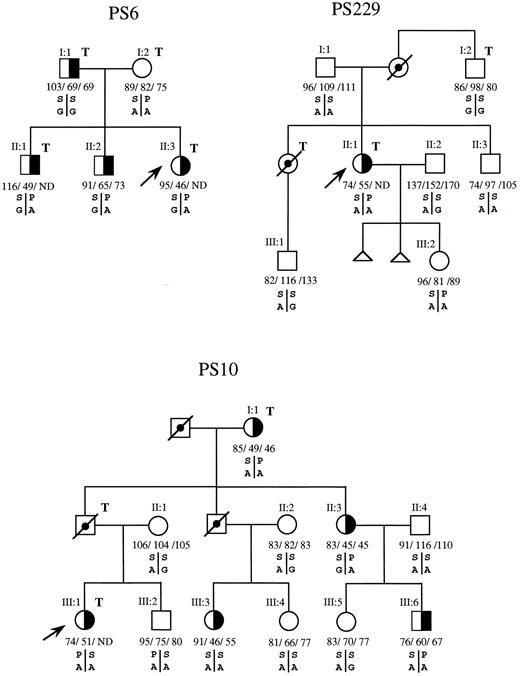 Fig. 1. Segregation patterns of the P626A/G and S460P polymorphisms in the PROS1 gene in families PS6, PS229, and PS10, indicating absence of cosegregation between the P or PS Heerlen allele of S460P and type III PS deficiency in families PS6 and PS229 and absence of linkage in family PS10. (╞, ◑) Heterozygosis for type III PS deficiency; (, ) not tested; (□, ○) deceased; (↗) propositus; T, thrombotic disease. Individual values for total PS antigen, free PS antigen, and PS activity are expressed as the percentage of normal and from left to right, respectively, below the corresponding symbol. ND, not determined. S or P are the serine or proline alleles at codon 460; A or G are the alleles for adenine or guanine at codon for proline 626.