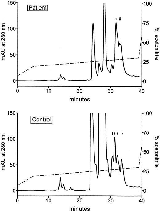 Fig. 2. RP-HPLC analysis of pooled fractions from the Q Sepharose FF chromatography step (see Fig 1). The pooled top fractions, T and t, from the patient sample (upper panel) and the normal sample (lower panel), respectively, were applied to a C-4 column, eluted with a linear gradient of acetonitrile (dotted line), and the effluent monitored as the absorbance at 214 nm (data not shown) and 280 nm. Fractions were collected and analyzed for protein C(immunological). The fractions containing protein C (indicated by vertical arrows) were pooled and used for further studies.