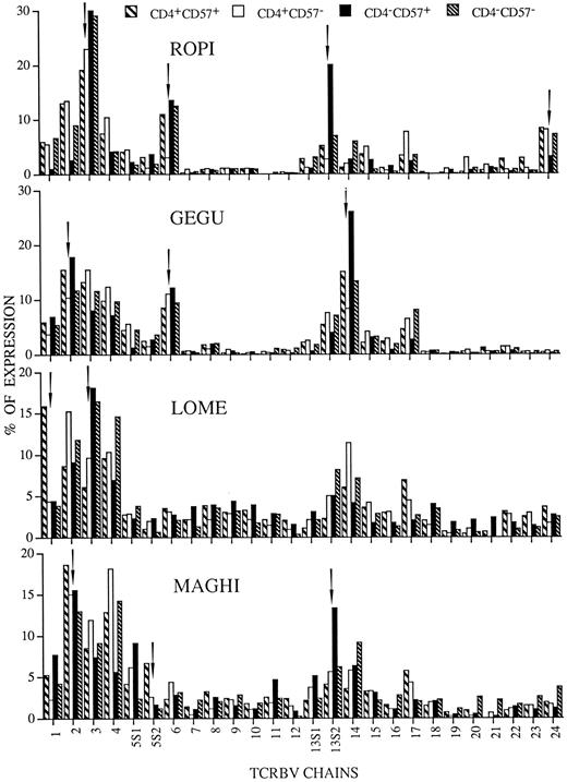 Fig. 1. TCRBV expression by CD4+CD57+ (▧), CD4+CD57− (□), CD4−CD57+ (▪), and CD4−CD57− (▧) cell subpopulations prepared from the RA patients ROPI, GEGU, LOME, and MAGHI. The data are expressed as percentage of the colorimetric signal obtained with the individual TCRBV specific probes and each graphic represents the mean of two independent experiments. Arrows indicate the TCRBV families in which the chain is abnormally expressed in at least one of the four T-cell subpopulations.