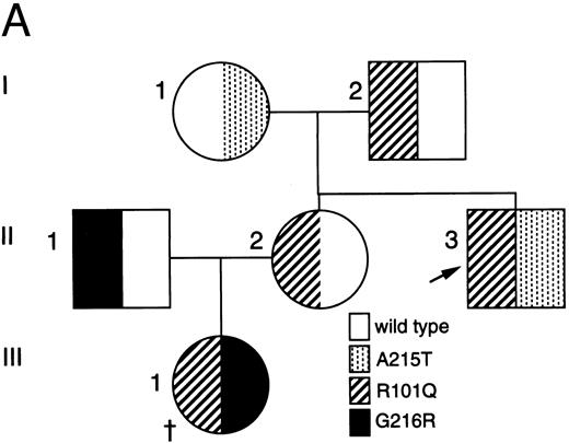 Fig. 2. Analysis of ADA cDNA and genomic DNA of patient no. 2 and family. (A) Pedigree of family 2. Arrow indicates patient no. 2 (II-3); † indicates the deceased proband (III-1), an infant with SCID whose genotype is presumed. (B) Sequence of genomic exon 7 DNA (patient no. 2, left; control, right). Patient no. 2 is heterozygous for the A215T mutation. (C) Ethidium-stained agarose gel illustrating the method of screening cDNA clones for the R101Q mutation and for retention of exon 7 (see the Materials and Methods). Numbers at right indicate length in nucleotides of DNA markers. Lanes 1 and 2, PCR fragments (exons 1 to 8) digested with Bsg I. Lane 1, clone bearing R101Q mutation (cuts with Bsg I); lane 2, clone with wild-type (R101) exon 4 (lacks Bsg I site). Lanes 3 and 4, PCR fragments (exons 5 to 11) digested with Nci I. Lane 3, clone containing exon 7 (cuts with Nci I within exon 7); lane 4, clone with a deletion of exon 7 (lacks exon 7 Nci I site).