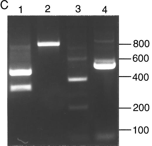 Fig. 2. Analysis of ADA cDNA and genomic DNA of patient no. 2 and family. (A) Pedigree of family 2. Arrow indicates patient no. 2 (II-3); † indicates the deceased proband (III-1), an infant with SCID whose genotype is presumed. (B) Sequence of genomic exon 7 DNA (patient no. 2, left; control, right). Patient no. 2 is heterozygous for the A215T mutation. (C) Ethidium-stained agarose gel illustrating the method of screening cDNA clones for the R101Q mutation and for retention of exon 7 (see the Materials and Methods). Numbers at right indicate length in nucleotides of DNA markers. Lanes 1 and 2, PCR fragments (exons 1 to 8) digested with Bsg I. Lane 1, clone bearing R101Q mutation (cuts with Bsg I); lane 2, clone with wild-type (R101) exon 4 (lacks Bsg I site). Lanes 3 and 4, PCR fragments (exons 5 to 11) digested with Nci I. Lane 3, clone containing exon 7 (cuts with Nci I within exon 7); lane 4, clone with a deletion of exon 7 (lacks exon 7 Nci I site).
