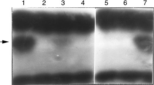 Fig. 3. In situ stain for ADA activity of in vitro translation products. Arrow indicates position of human ADA. The dark bands at the bottom and top are rabbit hemoglobin and rabbit ADA, respectively, carried over from the reticulocyte translation reaction. The translation reactions were primed with the normal (wild-type) or mutant human ADA mRNAs (transcribed from cDNA); lane 1, wild-type control; lane 2, blank; lane 3, A215T (patient no. 2); lane 4, R101Q (patient no. 2); lane 5, P126Q (patient no. 1); lane 6, G216R (patient no. 1); lane 7, wild-type control.
