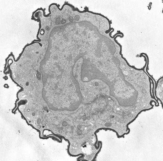 Esterase ectoenzyme on the cell surface of a peripheral blood monocyte from a patient with mycosis fungoides. (Original magnification × 14,500.) (Courtesy of Ann M. Dvorak, MD, Department of Pathology, Beth Israel Hospital, Harvard Medical School, 330 Brookline Ave, Boston, MA 02215.)