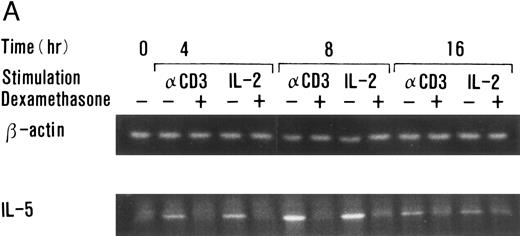 Fig. 4. Dexamethasone suppressed IL-5 gene expression of human T-cell clones stimulated via TCR and IL-2R. (A) T-cell clone (YA5, 2 × 106/well) was cultured in 24-well culture plates for the designated time periods. Some wells were pretreated with OKT3 MoAb (10 μg/mL), as indicated. rIL-2 (100 U/mL) was added to the designated wells. Dexamethasone (100 nmol/L) was included throughout the culture period in some wells, as indicated. Cells were harvested after 0, 4, 8, and 16 hours. Total RNA was then extracted, reverse transcribed, and amplified by PCR. The 279- and 1,128-bp products correspond with the expected size of IL-5 and β-actin amplification products, respectively. (B) T-cell clone (HK2 and HK5) was stimulated for 8 hours.