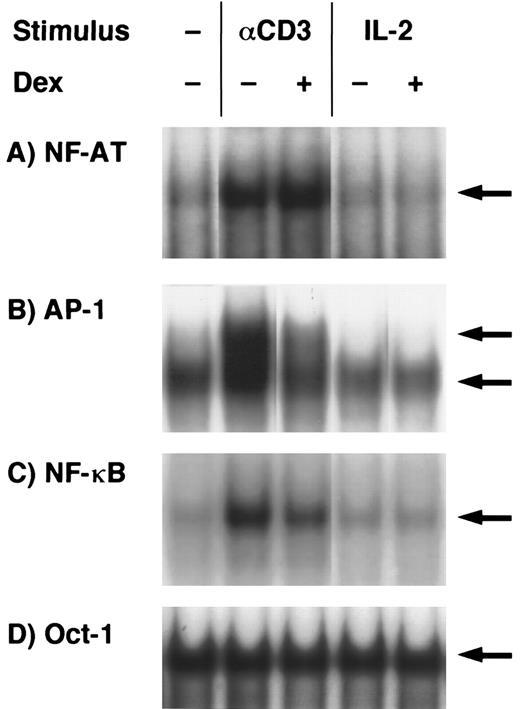 Fig. 5. Effects of dexamethasone on NF-AT, AP-1, NF-κB, and Oct-1 binding activities. T-cell clones (YA5) were stimulated with immobilized anti-CD3 MoAb or rIL-2 (100 U/mL) for 2 hours. Dexamethasone (1 μmol/L) was added to some cultures throughout the culture period, as indicated. Nuclear proteins were then extracted and DNA binding activity was measured by EMSA. Arrows indicate specific binding to NF-AT (A), AP-1 (B), NF-κB (C), and Oct-1 (D) oligonucleotides.