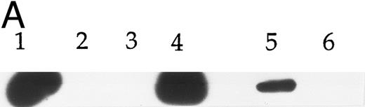 Fig. 4. Detection of the E2A/pbx1 chimeric protein in patient bone marrow specimens using the G289-781 MoAb. (A) Western blot analysis of specimens from four representative patients (lanes 1 to 4), 697 cell lysate (lane 5), and Namalwa cell lysate (lane 6) using the G289-781 MoAb. (B) Flow cytometric analyses of the same patient specimens with an isotype control antibody (- - - -) or G289-781 MoAb (——). (C) Representative immunohistochemical staining of bone marrow specimens from patient 1 (top) and patient 3 (bottom) using an isotype-matched negative control antibody (left), an E2A-specific positive control antibody (G98-271.1, center), and the E2A/pbx1-specific G289-781 MoAb (right).
