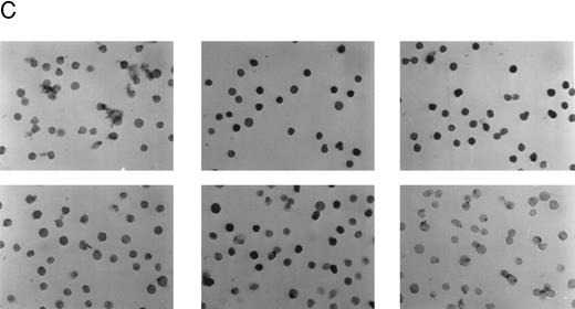 Fig. 4. Detection of the E2A/pbx1 chimeric protein in patient bone marrow specimens using the G289-781 MoAb. (A) Western blot analysis of specimens from four representative patients (lanes 1 to 4), 697 cell lysate (lane 5), and Namalwa cell lysate (lane 6) using the G289-781 MoAb. (B) Flow cytometric analyses of the same patient specimens with an isotype control antibody (- - - -) or G289-781 MoAb (——). (C) Representative immunohistochemical staining of bone marrow specimens from patient 1 (top) and patient 3 (bottom) using an isotype-matched negative control antibody (left), an E2A-specific positive control antibody (G98-271.1, center), and the E2A/pbx1-specific G289-781 MoAb (right).