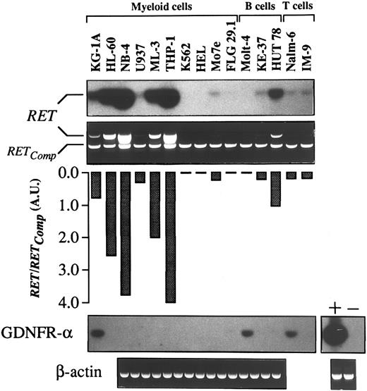 Fig. 4. Constitutive expression of RET transcripts (semiquantitative RT-PCR) and GDNFR-α (RT-PCR) in human leukemia/lymphoma cell lines. One microgram of total RNA was reverse-transcribed in a 20-μL reaction mix containing hexadeoxyribonucleotides random primers. Conditions for RT-PCR, blotting, hybridization, semiquantitative analysis, and controls were as described in Fig 2.