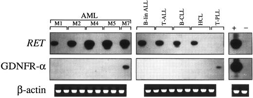 Fig. 5. Constitutive expression of RET transcripts and GDNFR-α in leukemic cells of myeloid origin (left panels) and in malignant cells from lymphoid tumors (right panels), as assessed by RT-PCR. One microgram of total RNA from AML cases (identified according to their FAB classification) and various lymphoid tumors was reverse-transcribed and amplified with primers specific for RET and GDNFR-α. PCR products were resolved on agarose gel, blotted, and hybridized with specific RET and GDNFR-α oligoprobes. An adult human brain substantia nigra cDNA and cDNA derived from the MN-60 cell line were used, respectively, as positive (+) and negative (−) controls for RET and GDNFR-α expression. cDNAs were always tested with β-actin–specific primers.