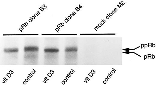 Fig. 10. Production of the retinoblastoma protein and changes in its degree of phosphorylation on induction of differentiation in Rb-transfected clones. Indicated U-937 clones (RB transfectants B3 and B4 and mock-transfectant M2) were induced with Vit D3 (0.1 μmol/L). At 0 and 24 hours, cells were harvested and indicated clones were biosynthetically labeled for 2 hours with 35S-methionine/cysteine. Labeled proteins were subjected to immunoprecipitation with an anti-pRb antibody followed by 7% SDS-PAGE and fluorography, as described in the Materials and Methods. Immunoprecipitated pRb of different molecular weights are indicated with arrows (ppRb, hyperphosphorylated; pRb, hypophosphorylated).