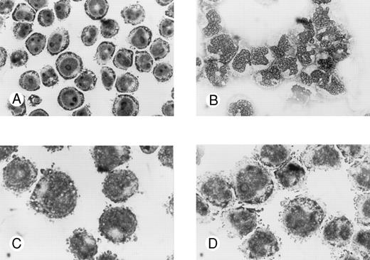 Fig. 3. Effects of oligonucleotides on morphologic changes on induced differentiation of wild-type U-937 cells. Cells at an initial concentration of 0.2 × 106 cells/mL were preincubated for 24 hours with oligonucleotides at a concentration of 50 μmol/L. Cells were then induced with ATRA at 1 μmol/L. After 4 days of induction in the continuous presence of antisense Rb oligonucleotides or oligo buffer, cytospin slides were prepared and stained with May-Grünwald-Giemsa. Simultaneously, noninduced cells were incubated with antisense Rb oligonucleotides or oligo buffer and used as controls. Morphology was investigated by light microscopy. Cells incubated with oligo buffer only (A); with ATRA and oligo buffer (B); with antisense Rb oligonucleotides only (C); or with ATRA and antisense Rb oligonucleotides (D).