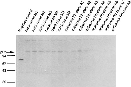 Fig. 4. Biosynthetic labeling of pRb. Indicated U-937 clones were biosynthetically labeled for 2 hours with 35S-methionine/cysteine and labeled proteins were subjected to immunoprecipitation with an anti-pRb antibody or a negative control antibody followed by SDS-PAGE and fluorography, as described in the Materials and Methods. Molecular weights are indicated to the left (in kilodaltons). Immunoprecipitated pRb is indicated with an arrow.