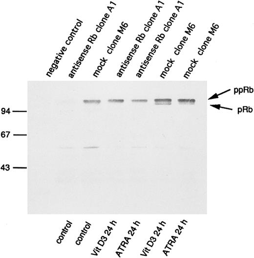 Fig. 5. Changes in levels of the retinoblastoma protein and its degree of phosphorylation on induction of differentiation. Indicated U-937 clones (antisense Rb clone A1 and mock clone M6) were induced with ATRA (1 μmol/L) or Vit D3 (0.1 μmol/L). At 0 and at 24 hours, cells were harvested and subjected to protein extraction followed by specific immunoprecipitation with an antiretinoblastoma protein antibody, 7% SDS-PAGE, and Western blot analysis, as described in the Materials and Methods. Molecular weights are indicated to the left (in kilodaltons). Immunoprecipitated pRb of different molecular weights are indicated with arrows (ppRb, hyperphosphorylated; pRb, hypophosphorylated).